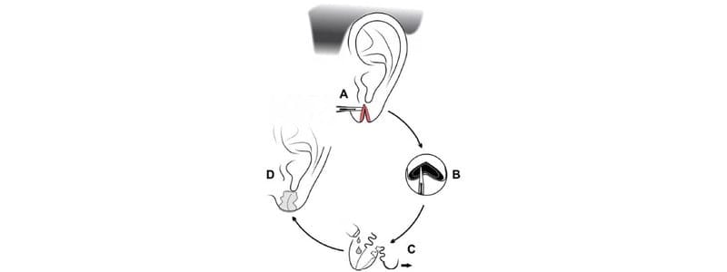 Ear hole tear: Understanding the Condition